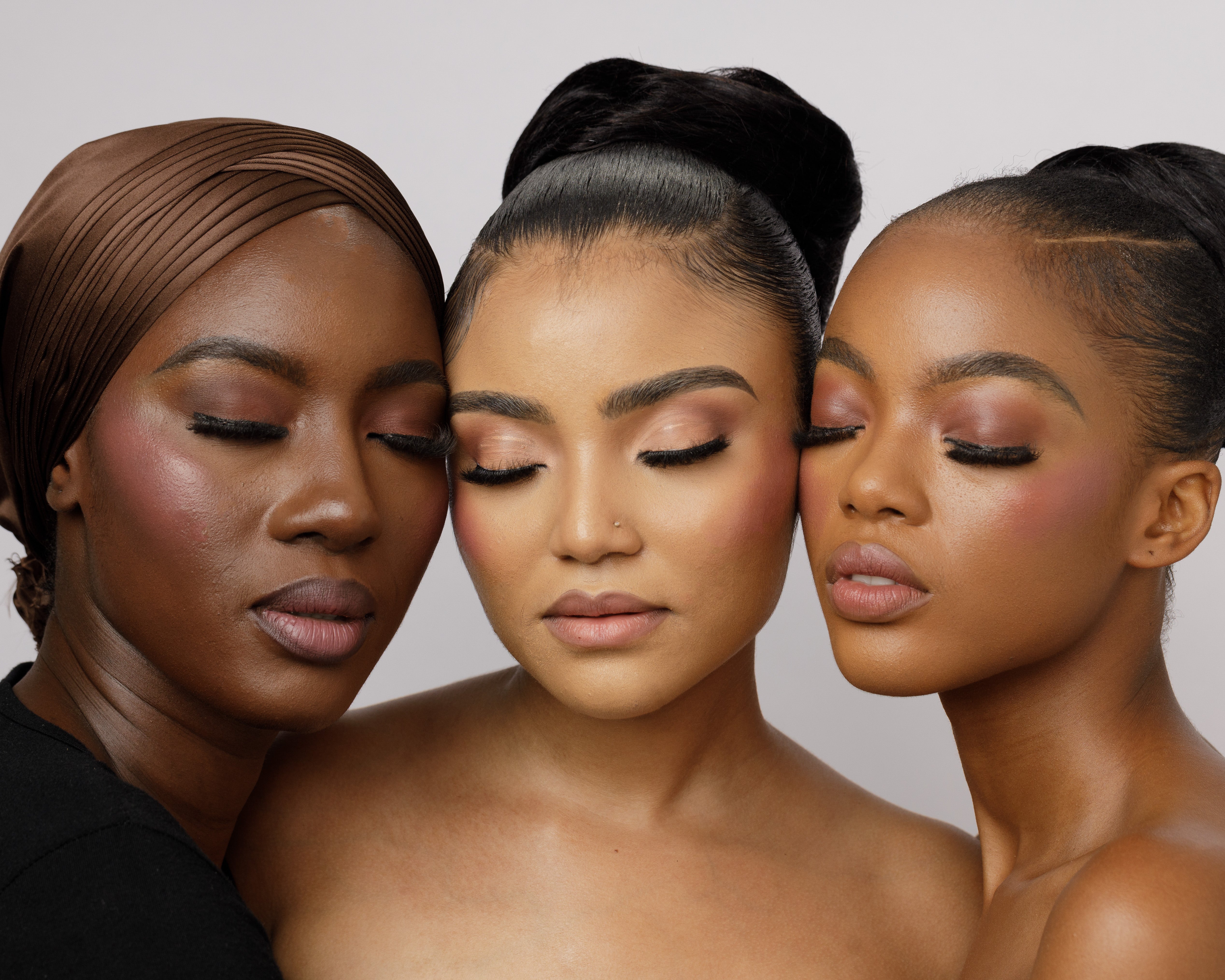 Understanding Hyperpigmentation: Why It Happens and How to Treat It